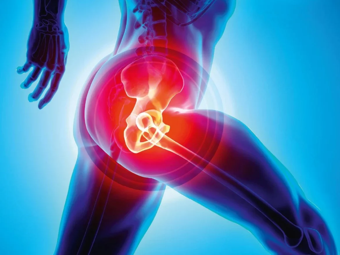Hip-replacement-surgery What is the cost of hip replacement surgery in 2023 in Prakasam, Andhra Pradesh, India?