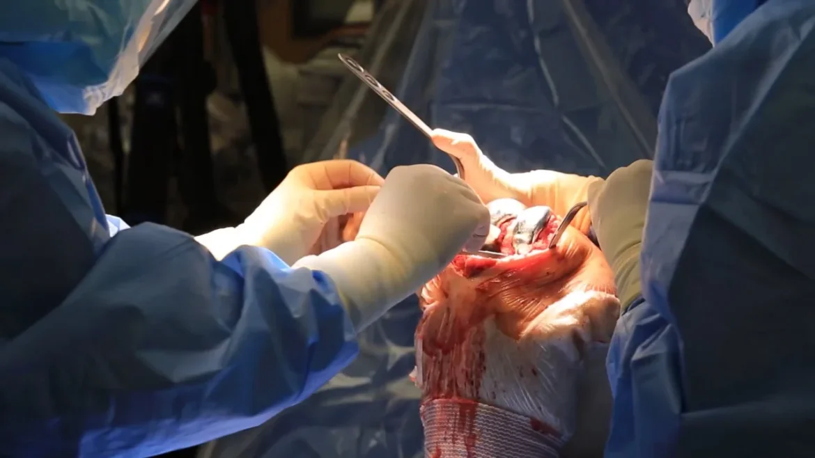 image Why Is Knee Replacement Surgery Necessary?