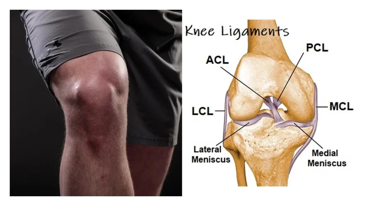 knee-ligament-surgery How to Test for Knee Ligament Injury: A Comprehensive Guide