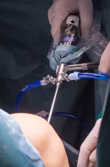 knee anthroscopy in guntur