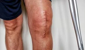 Best knee Doctor in Guntur