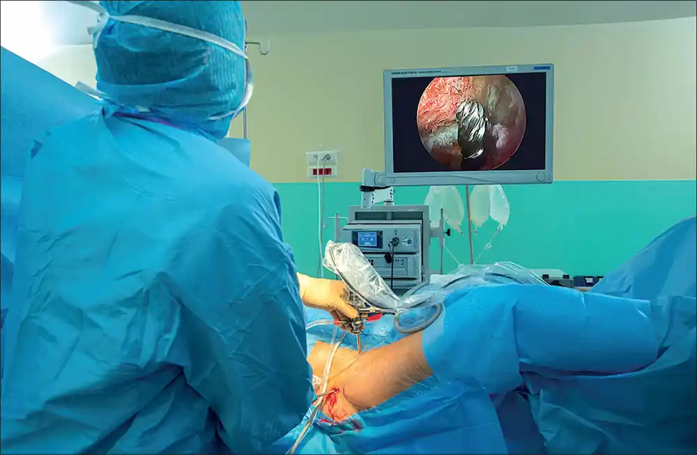 Hip Anthroscopy In Guntur