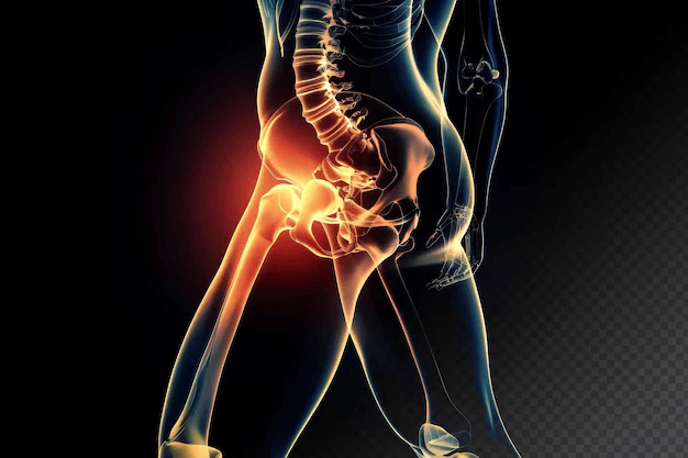 Hip Pain Relief in
                                                                                    Guntur