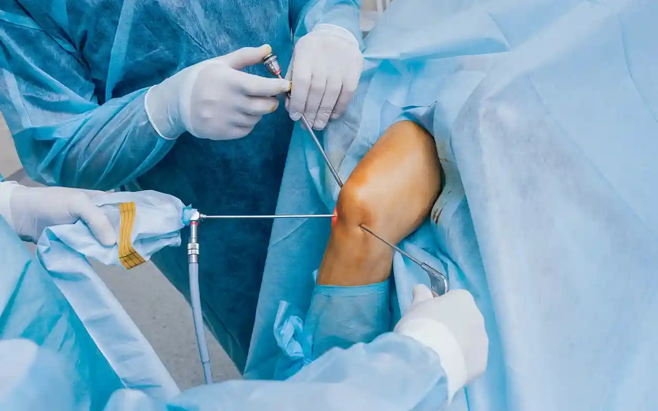 Arthroscopy In Guntur