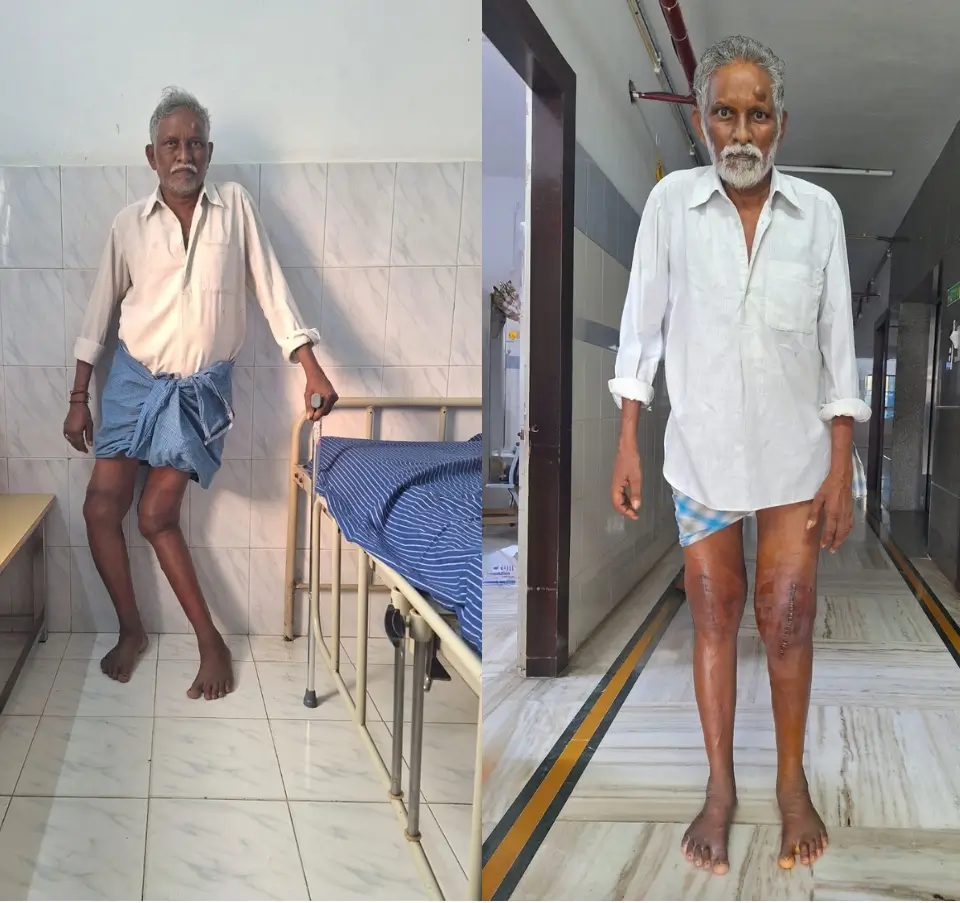 best knee replacement surgeon guntur