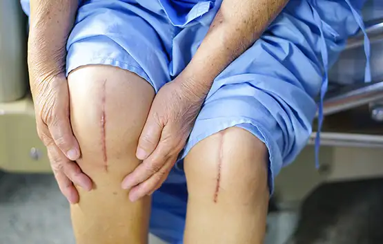 Knee Joint replacement in Vijaywada
