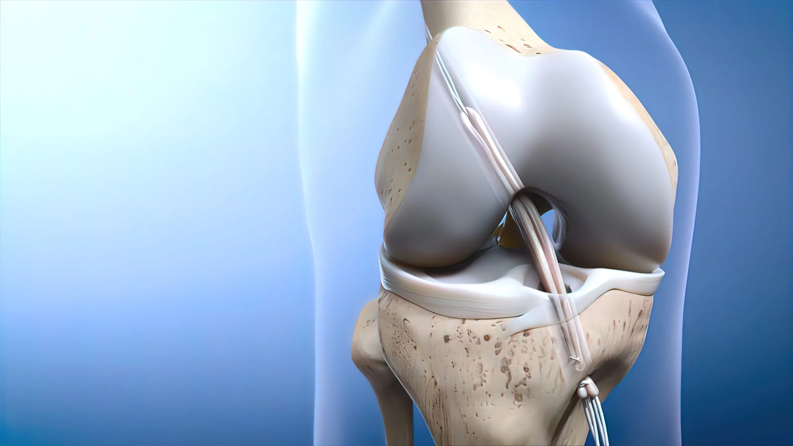 acl reconstruction surgery cost