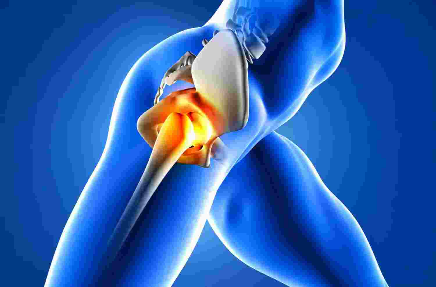 AVN Of Hip specialist