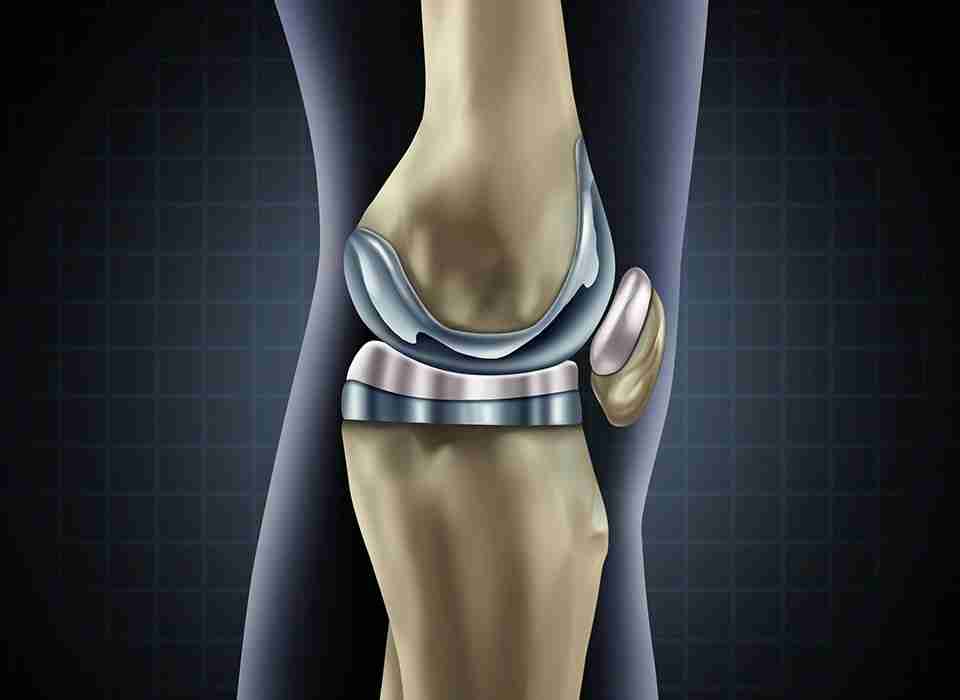 Best Knee Surgeon in Andhra
                                                                            Pradesh