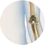 orthopedic surgery for elbow replacement in guntur